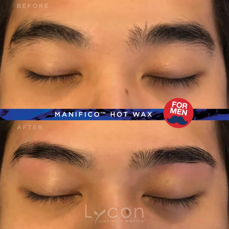 MANifico before and after hair removal